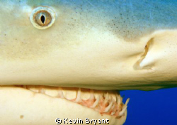 Periodontal exam by Kevin Bryant 